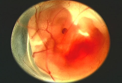 胎儿十月发育过程图