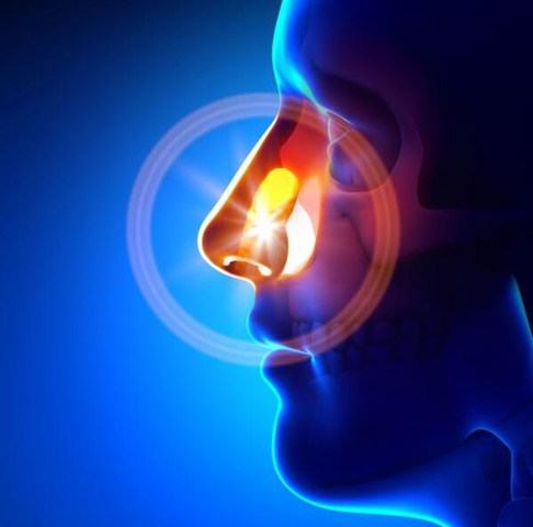 慢性鼻窦炎的最好治疗方法